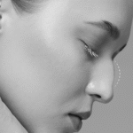 تصویر قبل از درمان